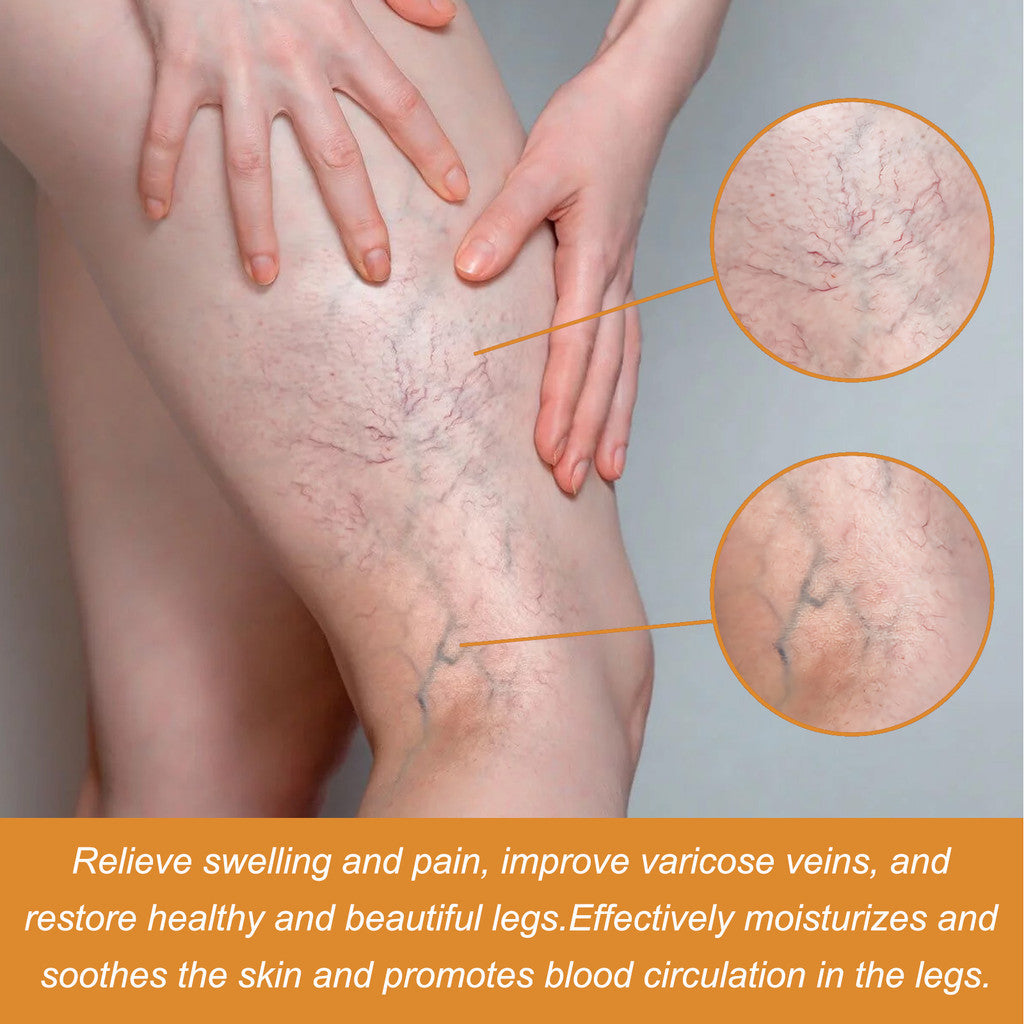Richavita™ Varicose Veins  Spray
